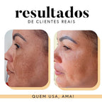 Fórmula Antioxi Nutri - 30 cápsulas