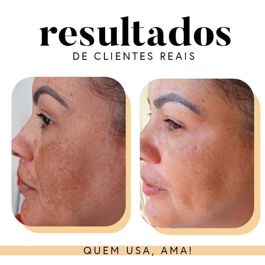 Fórmula Antioxi Nutri (90 cápsulas – 3 meses)