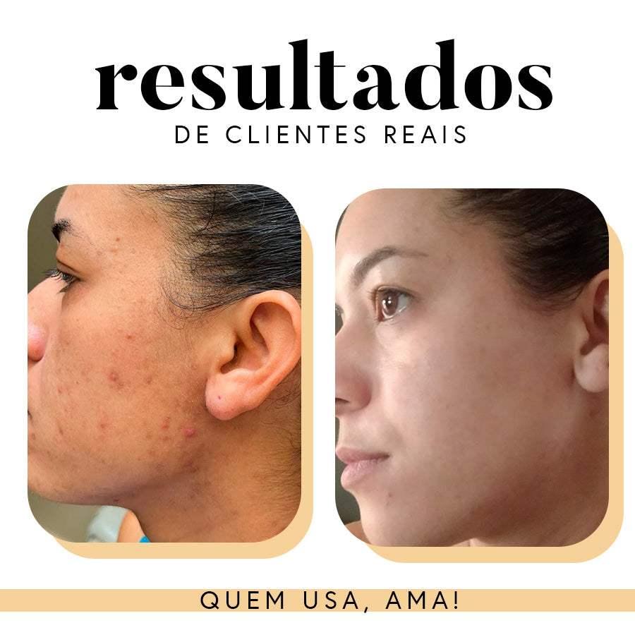 Fórmula Antioxi Nutri (90 cápsulas – 3 meses)