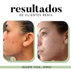 Fórmula Antioxi Nutri - 30 cápsulas