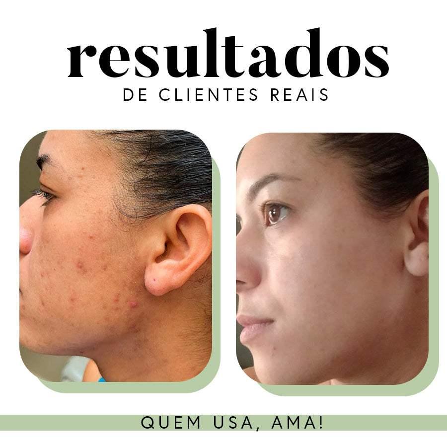 Fórmula Antioxi Nutri - 30 cápsulas
