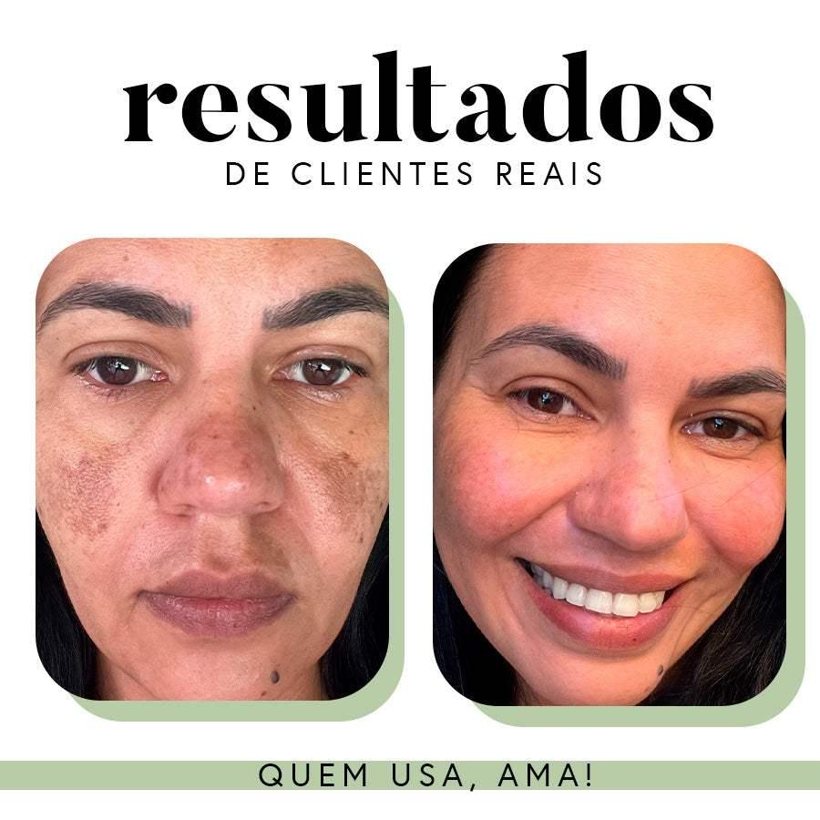 Fórmula Antioxi Nutri - 30 cápsulas