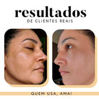 Fórmula Antioxi Nutri (90 cápsulas – 3 meses)