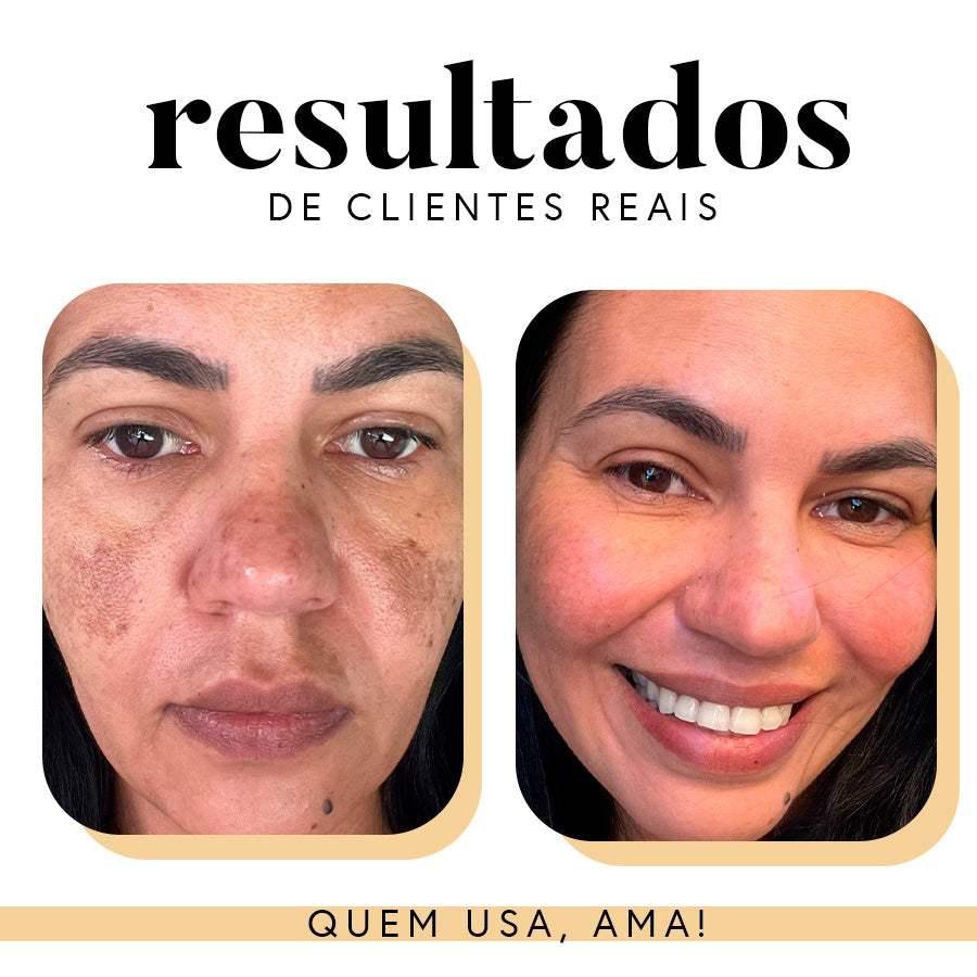Fórmula Antioxi Nutri (90 cápsulas – 3 meses)