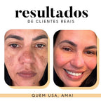 Fórmula Antioxi Nutri (90 cápsulas – 3 meses)